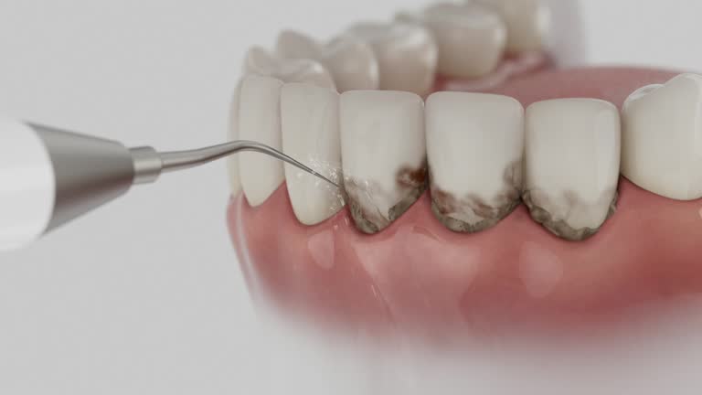 Trusted Wisdom Tooth Removal service in Point MacKenzie, AK - Dentist Open Now